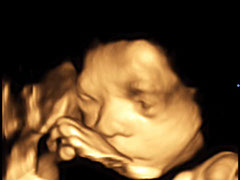 Baby 4D Ultraschall