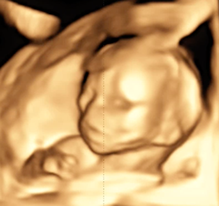 Hier zeigt ein kleiner Film einen 4D-Ultraschall